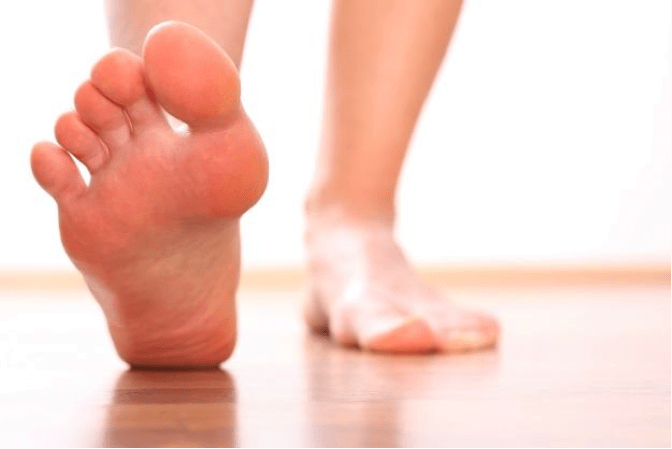 Alluce valgo: sintomi, cure ed esercizi