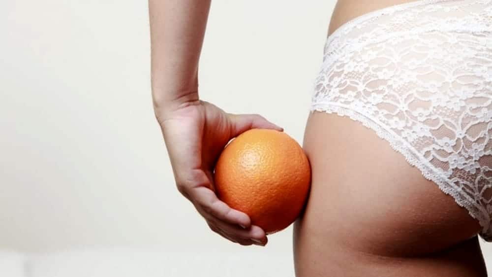 Cellulite: cos’è e come sconfiggerla!